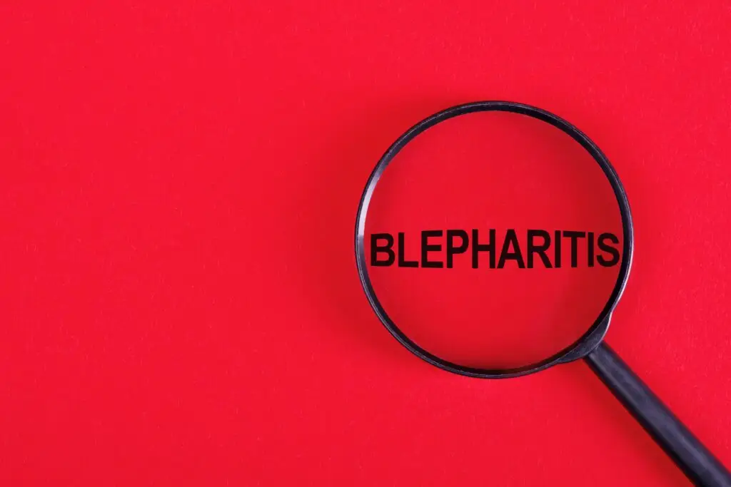 Blepharitis
